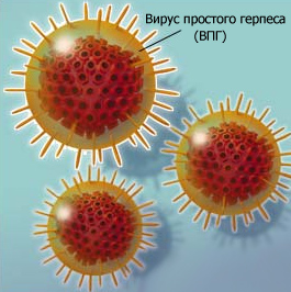 ВПГ первого типа герпесвирус простой